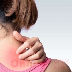 Home remedies for itchy skin